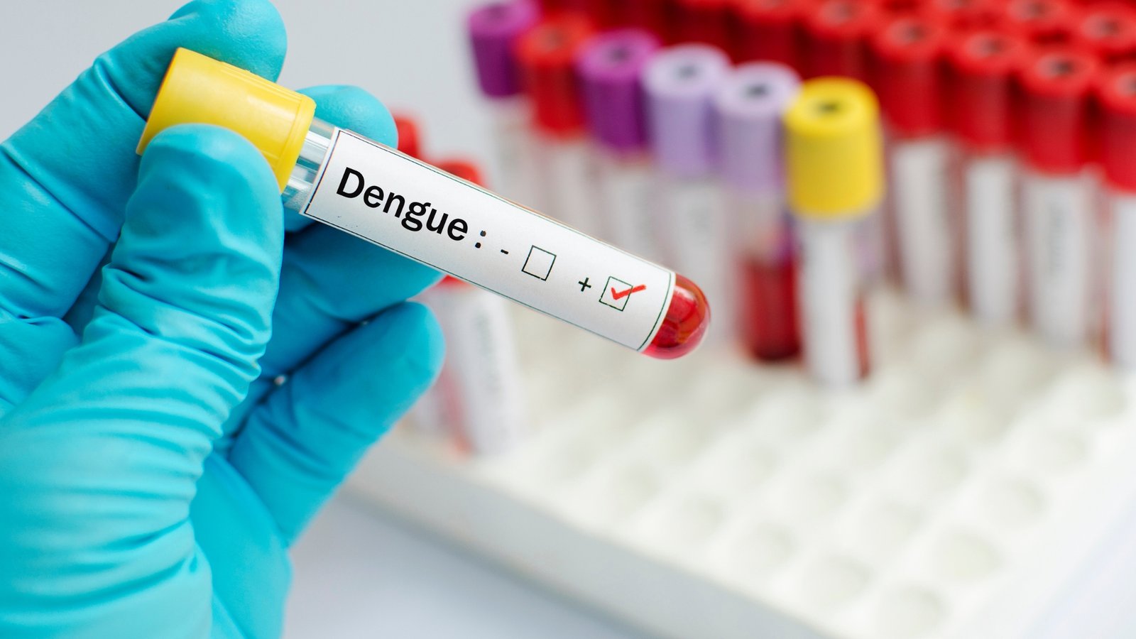A gloved hand holding a blood tube that tested positive for dengue fever