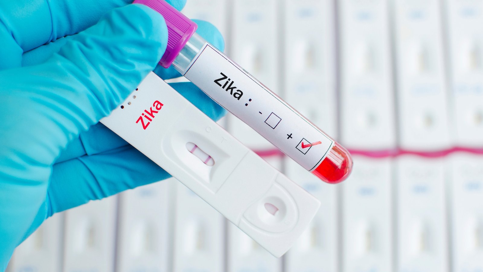 A vial of blood labeled as testing positive for Zika virus